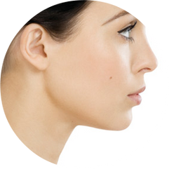 Can I have a tighter jaw and neck line?