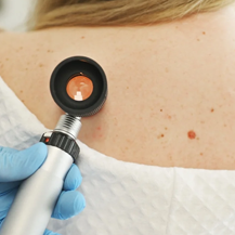 Dr Coleman discusses Managing Post-summer Pigmentation