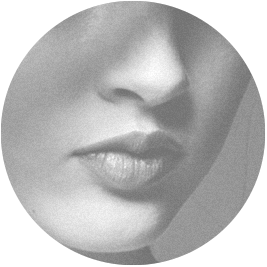 Melasma